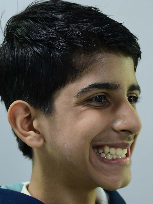 Children's Orthodontics - after