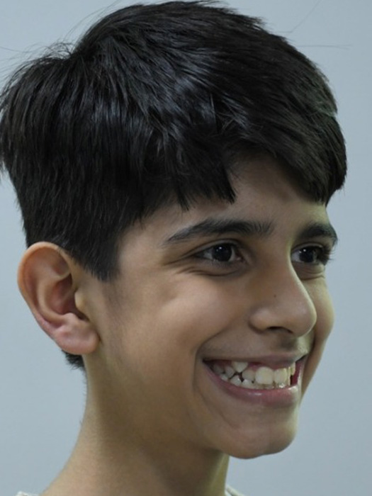 Children's Orthodontics - before