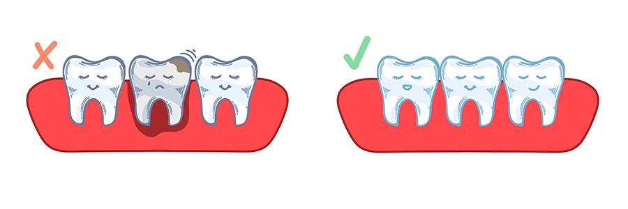 Periodontal Treatment