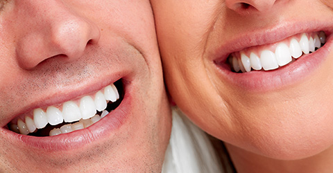 Dentist Beaconsfield - Tooth Whitening