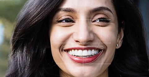 Dentist Beaconsfield - Invisalign Tooth Straightening